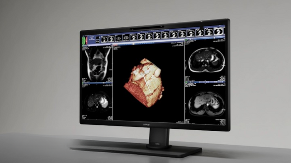Barco Eonis 3D (MDRC‑8127) Monitar