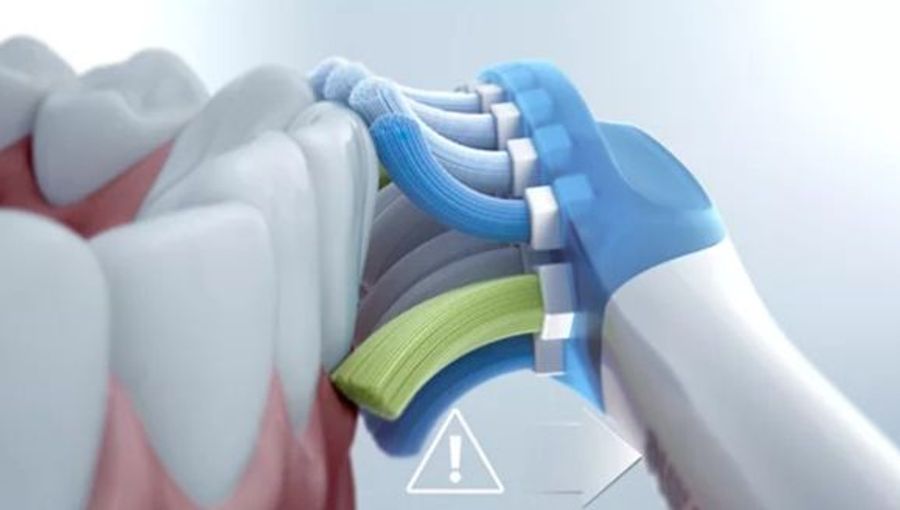 Philips Expertclean 7300 Electrical Toothbrush